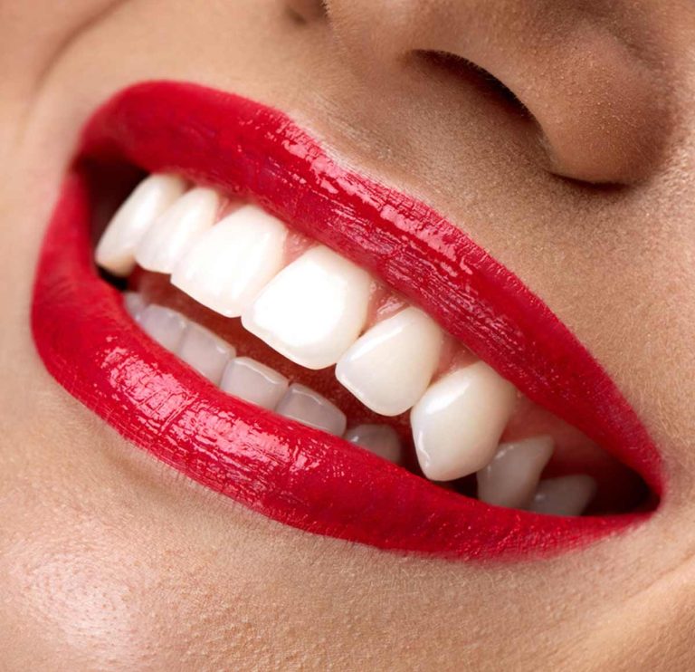 Strong and Durable: Get Zirconia Teeth in Dubai for a Long-Lasting Restoration